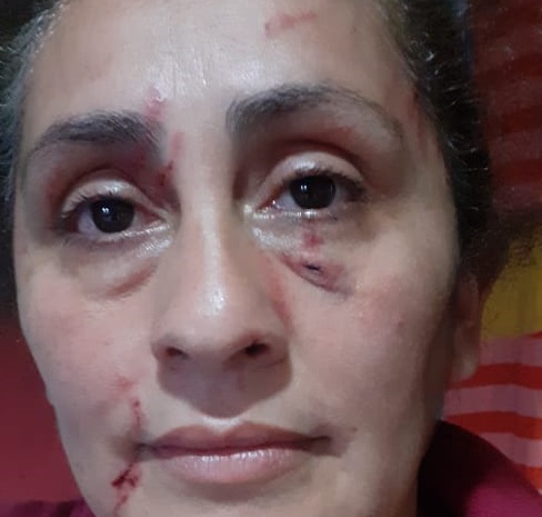 Las lesiones que sufrió la hermana del denunciado por parte de la mujer y que fuera denunciado en la Comisaría 28 el 27 de diciembre del 2020.